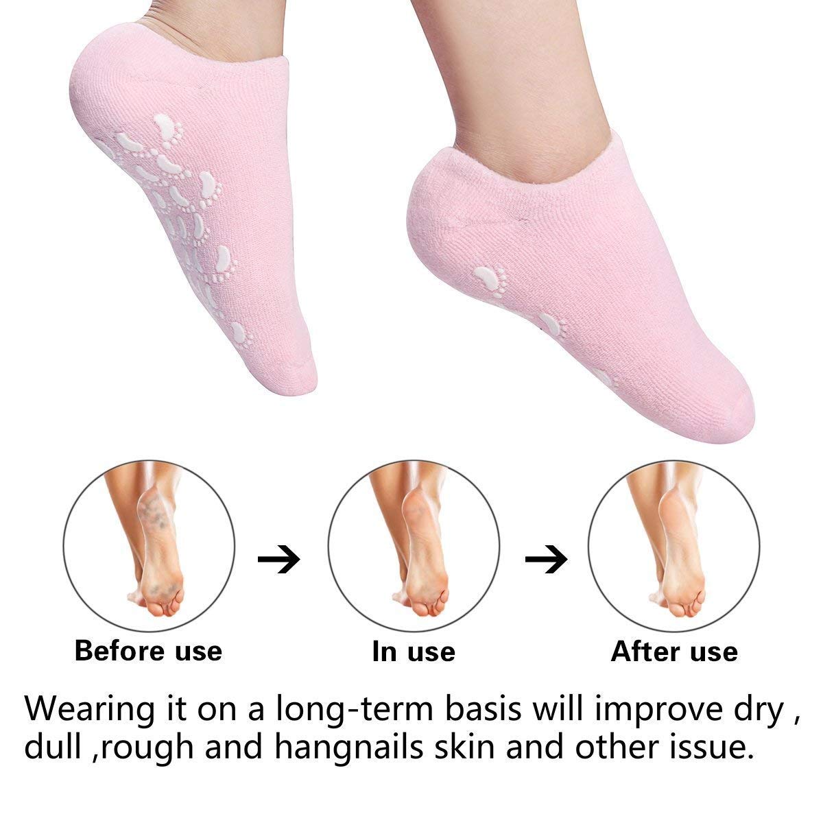 Moisturizing Socks with Spa Gel for Moisturizing Vitamin and Essential Oils Infused, Gel Socks for Women Repair Dry Cracked Skins Softens Feet
