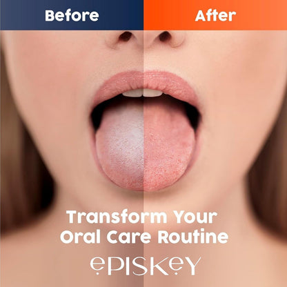 Stainless Steel Tongue Scrapers for Adults