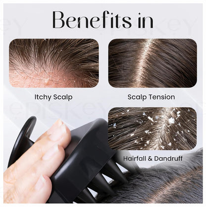Scalp Massager Shampoo Brush for Hair Wash Anti-Dandruff Silicone Scalp Scrubber with Soft Bristles